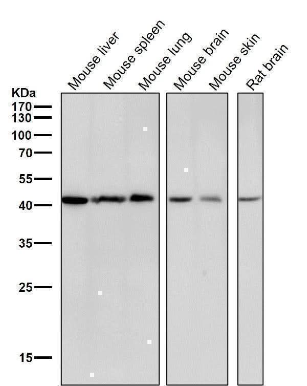 Anti-CABP Rabbit Monoclonal Antibody Boster Bio