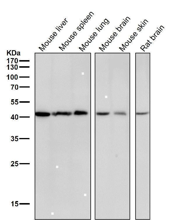 Anti-CABP Rabbit Monoclonal Antibody Boster Bio