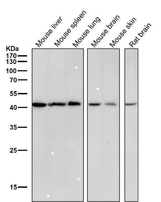 Anti-CABP Rabbit Monoclonal Antibody Boster Bio