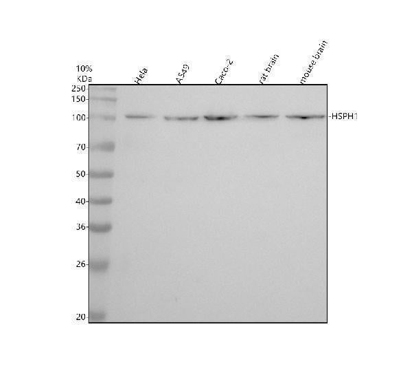 Anti-Hsp105 Rabbit Monoclonal Antibody Boster Bio