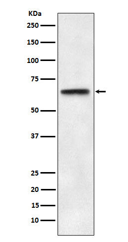 Anti-ABCE1 Rabbit Monoclonal Antibody Boster Bio