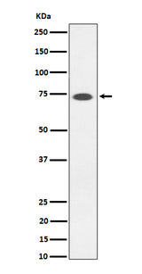 Anti-SSTR3 Rabbit Monoclonal Antibody Boster Bio