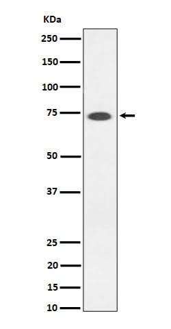 Anti-SSTR3 Rabbit Monoclonal Antibody Boster Bio