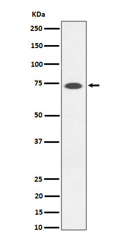 Anti-SSTR3 Rabbit Monoclonal Antibody Boster Bio
