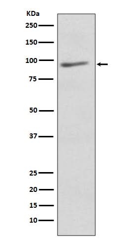Anti-EIF2C3 AGO3 Rabbit Monoclonal Antibody Boster Bio