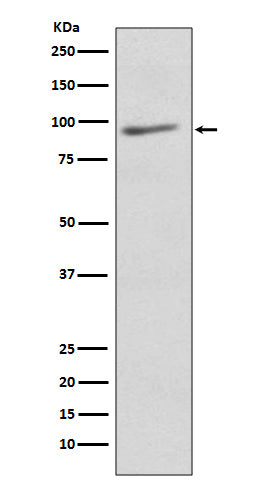 Anti-EIF2C3 AGO3 Rabbit Monoclonal Antibody Boster Bio