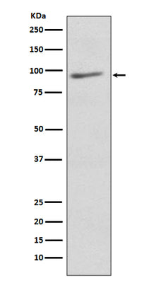 Anti-EIF2C3 AGO3 Rabbit Monoclonal Antibody Boster Bio