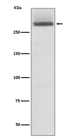 Anti-LAMA3/Laminin 5 Rabbit Monoclonal Antibody Boster Bio