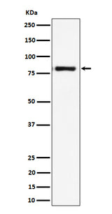 Anti-LTK Rabbit Monoclonal Antibody Boster Bio