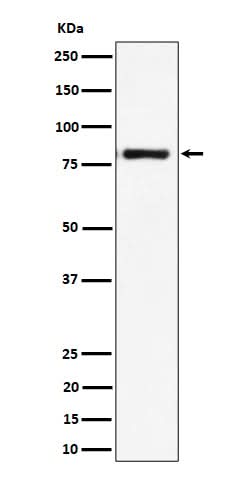 Anti-LTK Rabbit Monoclonal Antibody Boster Bio
