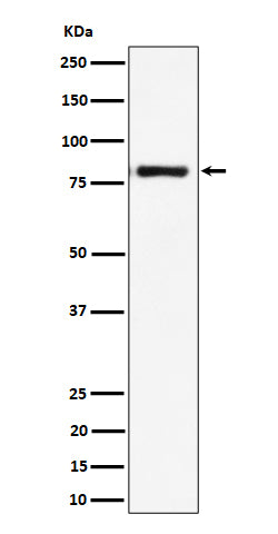 Anti-LTK Rabbit Monoclonal Antibody Boster Bio