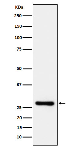 Anti-DcR1 / CD263 Rabbit Monoclonal Antibody Boster Bio