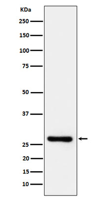 Anti-DcR1 / CD263 Rabbit Monoclonal Antibody Boster Bio