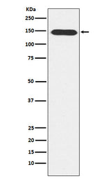 Anti-PLCB3 Rabbit Monoclonal Antibody Boster Bio