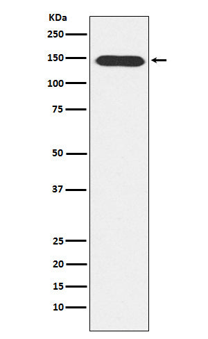Anti-PLCB3 Rabbit Monoclonal Antibody Boster Bio