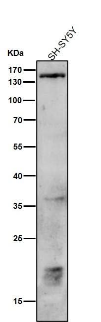 Anti-Phospho-PLCB3 (S537) Rabbit Monoclonal Antibody Boster Bio
