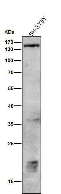Anti-Phospho-PLCB3 (S537) Rabbit Monoclonal Antibody Boster Bio