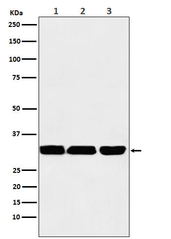 Anti-p53 DINP1 Rabbit Monoclonal Antibody Boster Bio