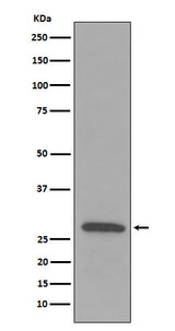 Anti-C1QB Rabbit Monoclonal Antibody Boster Bio