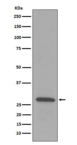 Anti-C1QB Rabbit Monoclonal Antibody Boster Bio