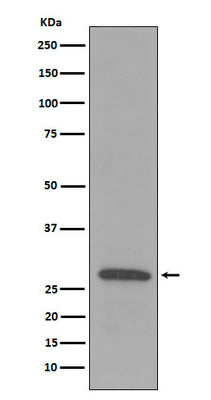 Anti-C1QB Rabbit Monoclonal Antibody Boster Bio