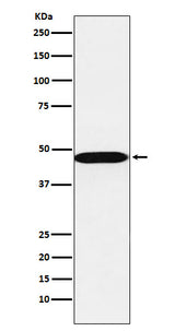 Anti-AHCY Rabbit Monoclonal Antibody Boster Bio