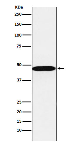 Anti-AHCY Rabbit Monoclonal Antibody Boster Bio