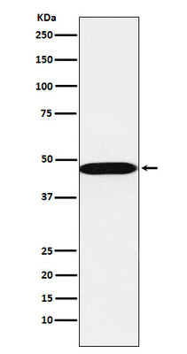 Anti-AHCY Rabbit Monoclonal Antibody Boster Bio