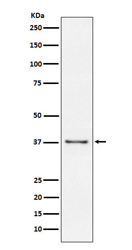 Anti-CD23 FCER2 Monoclonal Antibody Boster Bio