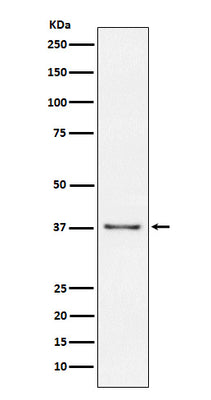Anti-CD23 FCER2 Monoclonal Antibody Boster Bio