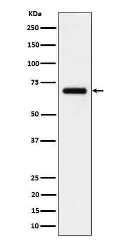 Anti-CD125 Rabbit Monoclonal Antibody Boster Bio