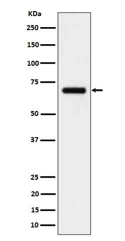 Anti-CD125 Rabbit Monoclonal Antibody Boster Bio