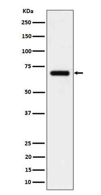 Anti-CD125 Rabbit Monoclonal Antibody Boster Bio