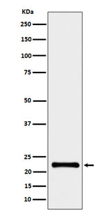 Anti-CRCP Rabbit Monoclonal Antibody Boster Bio