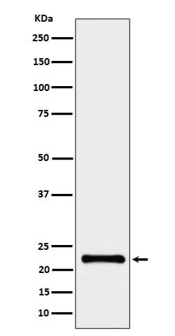 Anti-CRCP Rabbit Monoclonal Antibody Boster Bio