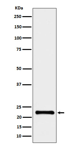 Anti-CRCP Rabbit Monoclonal Antibody Boster Bio