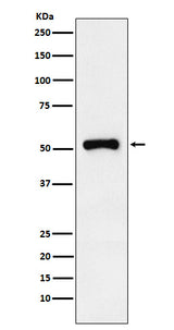 Anti-Retinoic Acid Receptor gamma Rabbit Monoclonal Antibody Boster Bio