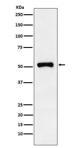 Anti-Retinoic Acid Receptor gamma Rabbit Monoclonal Antibody Boster Bio