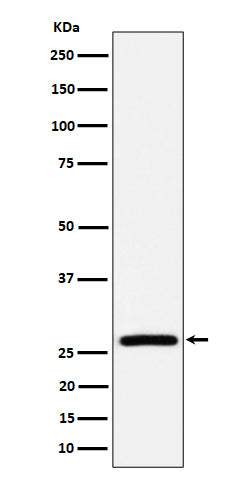 Anti-AK2 Rabbit Monoclonal Antibody Boster Bio