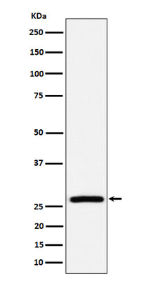 Anti-AK2 Rabbit Monoclonal Antibody Boster Bio