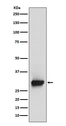 Anti-Calretinin Monoclonal Antibody Boster Bio