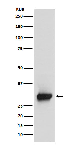 Anti-Calretinin Monoclonal Antibody Boster Bio