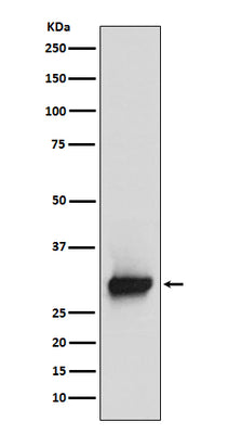 Anti-Calretinin Monoclonal Antibody Boster Bio