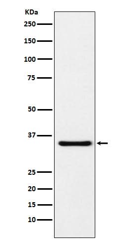 Anti-MDH1 Rabbit Monoclonal Antibody Boster Bio