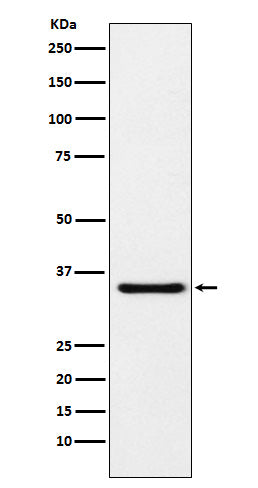 Anti-MDH1 Rabbit Monoclonal Antibody Boster Bio