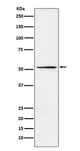 Anti-MEIS2 Rabbit Monoclonal Antibody Boster Bio