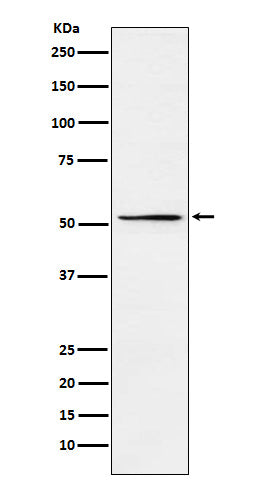 Anti-MEIS2 Rabbit Monoclonal Antibody Boster Bio