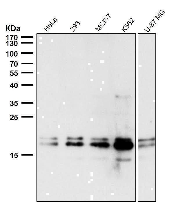 Anti-DUT Rabbit Monoclonal Antibody Boster Bio