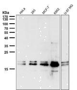 Anti-DUT Rabbit Monoclonal Antibody Boster Bio
