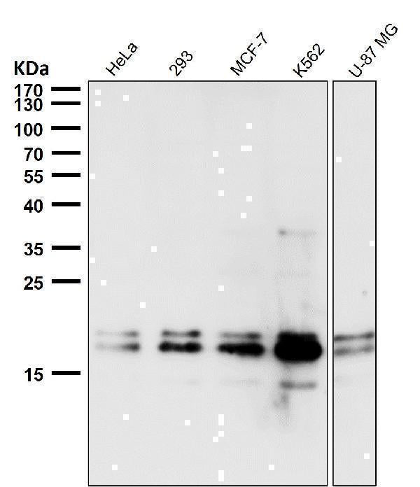 Anti-DUT Rabbit Monoclonal Antibody Boster Bio